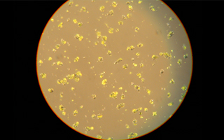 Magnetic Particle Seize